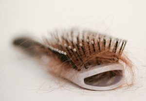 Covid-19 Vs Hair Loss