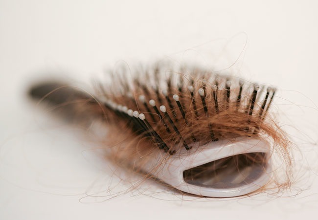 Covid-19 Vs Hair Loss