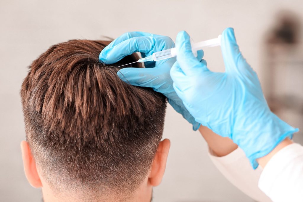 Doctor performing Regenera Activa® stem cell hair treatment on male patient experiencing early-stage hair loss.